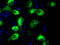 Lysyl Oxidase antibody, TA500866, Origene, Immunofluorescence image 
