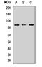 Leucine Rich Repeat And Sterile Alpha Motif Containing 1 antibody, LS-C668978, Lifespan Biosciences, Western Blot image 