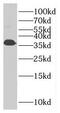 fTnT antibody, FNab08842, FineTest, Western Blot image 