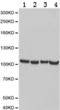 PMS1 Homolog 1, Mismatch Repair System Component antibody, TA323629, Origene, Western Blot image 