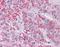 Metastasis Associated 1 antibody, orb89694, Biorbyt, Immunohistochemistry paraffin image 