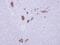 Armadillo Repeat Containing 1 antibody, GTX118227, GeneTex, Immunohistochemistry paraffin image 