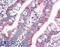 Fibroblast Growth Factor 5 antibody, 42-903, ProSci, Enzyme Linked Immunosorbent Assay image 