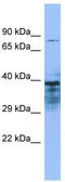 Zinc Finger MYND-Type Containing 15 antibody, TA333618, Origene, Western Blot image 