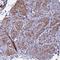 Molybdenum Cofactor Synthesis 1 antibody, HPA045783, Atlas Antibodies, Immunohistochemistry frozen image 