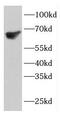 Electron transfer flavoprotein-ubiquinone oxidoreductase, mitochondrial antibody, FNab02877, FineTest, Western Blot image 