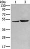 Zona Pellucida Like Domain Containing 1 antibody, PA5-67625, Invitrogen Antibodies, Western Blot image 
