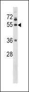 Fibrinogen Gamma Chain antibody, PA5-13528, Invitrogen Antibodies, Western Blot image 