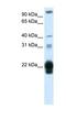 CSH1 antibody, NBP1-59302, Novus Biologicals, Western Blot image 