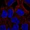 Enhancer Of MRNA Decapping 4 antibody, NBP2-55530, Novus Biologicals, Immunocytochemistry image 