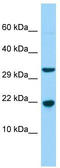 Calcium Binding Protein 5 antibody, TA331245, Origene, Western Blot image 