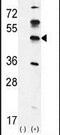 G Kinase Anchoring Protein 1 antibody, PA5-25388, Invitrogen Antibodies, Western Blot image 