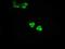 Glucokinase antibody, MA5-24929, Invitrogen Antibodies, Immunocytochemistry image 