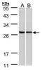 60S ribosomal protein L13a antibody, PA5-21430, Invitrogen Antibodies, Western Blot image 