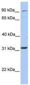 Extracellular Leucine Rich Repeat And Fibronectin Type III Domain Containing 2 antibody, TA342068, Origene, Western Blot image 