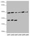 BCS1 Homolog, Ubiquinol-Cytochrome C Reductase Complex Chaperone antibody, LS-C675417, Lifespan Biosciences, Western Blot image 