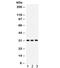 Voltage Dependent Anion Channel 1 antibody, R32009, NSJ Bioreagents, Western Blot image 