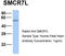 Mitochondrial Elongation Factor 1 antibody, TA331075, Origene, Western Blot image 