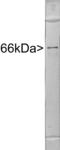 Internexin Neuronal Intermediate Filament Protein Alpha antibody, LS-B10374, Lifespan Biosciences, Western Blot image 