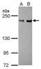 DNA repair protein complementing XP-G cells antibody, NBP2-20924, Novus Biologicals, Western Blot image 