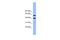 Allantoicase antibody, A13053, Boster Biological Technology, Western Blot image 