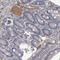 C-Reactive Protein antibody, HPA027367, Atlas Antibodies, Immunohistochemistry paraffin image 