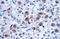 Ring Finger Protein 141 antibody, 28-125, ProSci, Enzyme Linked Immunosorbent Assay image 