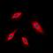 Alpha Kinase 1 antibody, orb382529, Biorbyt, Immunofluorescence image 