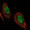 DNA repair protein complementing XP-G cells antibody, NBP2-47577, Novus Biologicals, Immunofluorescence image 