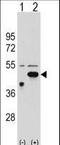 Ethanolamine kinase 2 antibody, LS-C167842, Lifespan Biosciences, Western Blot image 