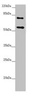 Centrosomal protein of 83 kDa antibody, LS-C675510, Lifespan Biosciences, Western Blot image 