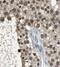 Coiled-Coil And C2 Domain Containing 1A antibody, FNab01335, FineTest, Immunohistochemistry frozen image 