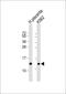 Hemoglobin Subunit Epsilon 1 antibody, A08093-1, Boster Biological Technology, Western Blot image 