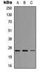 Neurogenin 1 antibody, LS-C354445, Lifespan Biosciences, Western Blot image 