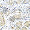 Eukaryotic Translation Initiation Factor 3 Subunit A antibody, A0573, ABclonal Technology, Immunohistochemistry paraffin image 