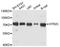 5-Hydroxytryptamine Receptor 2C antibody, A11831, ABclonal Technology, Western Blot image 