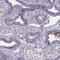 C3orf80 antibody, NBP2-48872, Novus Biologicals, Immunohistochemistry paraffin image 