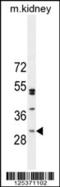 Chromosome 6 Open Reading Frame 62 antibody, 55-548, ProSci, Western Blot image 