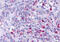 Leukotriene B4 Receptor antibody, MBS247386, MyBioSource, Immunohistochemistry paraffin image 