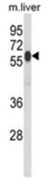 2-Hydroxyacyl-CoA Lyase 1 antibody, AP18151PU-N, Origene, Western Blot image 