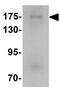 WASH Complex Subunit 5 antibody, GTX31457, GeneTex, Western Blot image 