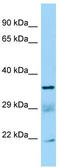 Succinate-CoA Ligase Alpha Subunit antibody, TA338204, Origene, Western Blot image 