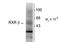 Retinoid X Receptor Beta antibody, orb96062, Biorbyt, Western Blot image 
