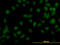 Non-receptor tyrosine-protein kinase TYK2 antibody, LS-C133501, Lifespan Biosciences, Immunofluorescence image 