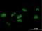 F-Box Protein 31 antibody, H00079791-B01P, Novus Biologicals, Immunocytochemistry image 