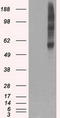 Synaptic vesicular amine transporter antibody, LS-C114563, Lifespan Biosciences, Western Blot image 
