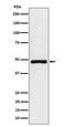 Phenylalanine-4-hydroxylase antibody, M00761, Boster Biological Technology, Western Blot image 