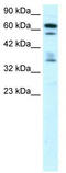 Zinc Finger Protein 512 antibody, TA329661, Origene, Western Blot image 