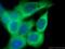 Rho GDP-dissociation inhibitor 1 antibody, 66434-1-Ig, Proteintech Group, Immunofluorescence image 