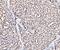 Small RNA Binding Exonuclease Protection Factor La antibody, A00705-1, Boster Biological Technology, Immunohistochemistry paraffin image 